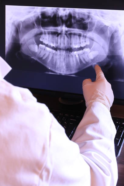 Teeth Whitening in WA