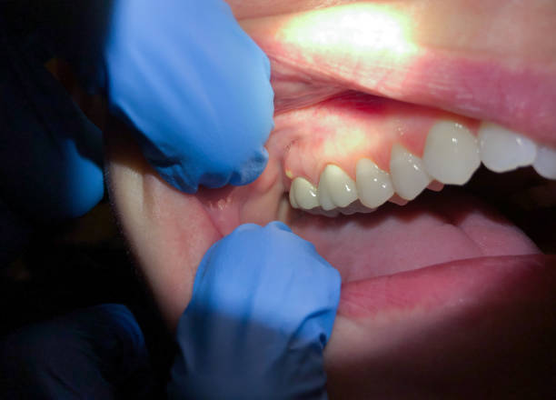 Best Dentist for Dental Trauma  in Langley, WA